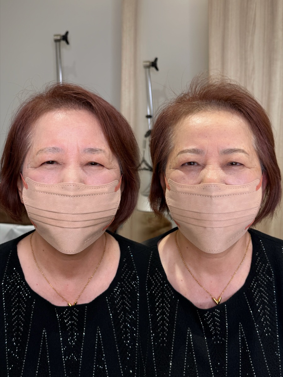 眉アートメイク Before / After